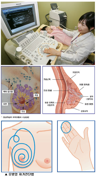 유방암 조기 발견을 위해선 증상이 없더라도 35세 이상 여성은 1년에 한 번은 정기검진을 받아야 한다. 정운철기자 woon@msnet.co.kr