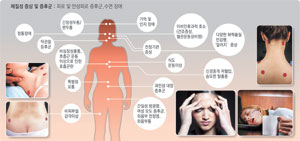 화가 프리다 칼로도 섬유근통 증후군으로 고통받은 것으로 알려져 있다. 그녀의 작품 