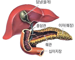 유두괄약근을 절개하자 흰색 고름이 나오고 있다. 이후 바스켓을 이용해 담석을 제거했다.