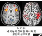 사진=자기공명영상장치를 이용한 다양한 종류의 뇌영상.