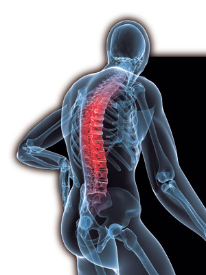 척추골절이 있으면 우선 움직임을 최소화해서 저절로 아물게 하는 보존적 치료를 한다. 만약 이런 방법이 별 효과를 거두지 못하면 수술이 필요할 수도 있다. 어떤 치료법이든 금연은 반드시 필요하다.