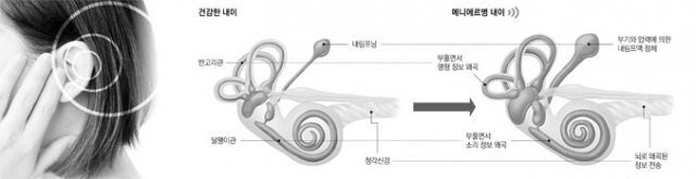 메니에르병은 심한 어지러움과 청력 저하, 귀울림 등을 동반하는 질환이다. 환자를 진료 중인 배창훈 영남대병원 이비인후과 교수. 영남대병원 제공