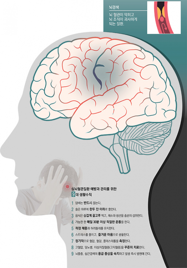 김용원 경북대병원 신경과 교수