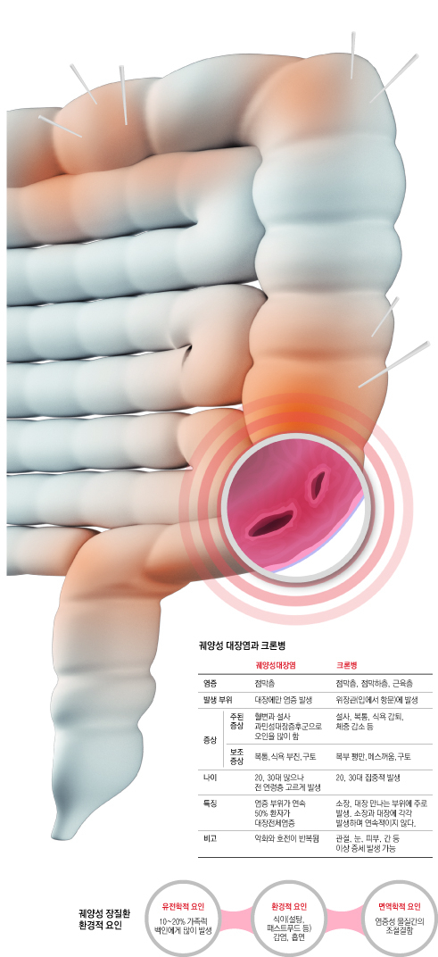 인구 10만명당 발병률