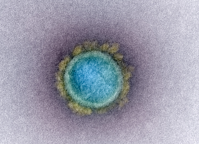 신종 코로나바이러스. 미국 국립보건원(NIH) 제공