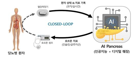 큐어스트림 인공췌장 시스템 알고리즘. 대구창조경제혁신센터 제공