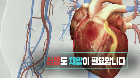 [TV] 심혈관 질환자에게 꼭 필요한 심장 재활  