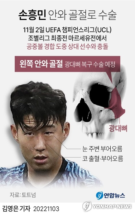 손흥민 안와 골절 수술. 연합뉴스