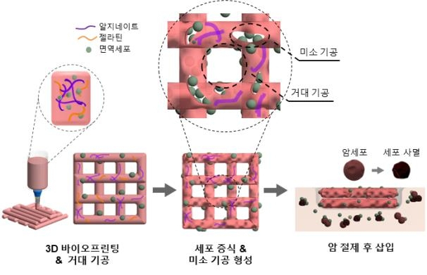 3D 바이오프린팅 NK 세포의 면역 치료 과정. 한국기계연구원 제공.