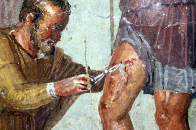 트로이 전쟁시기 명의 이아픽스가 아이네이아스 허벅지에 꽂힌 화살촉 제거 수술을 펼치고 있다. 1세기 로마 프레스코. 폼페이 출토. 로마 팔라조 마시모 고고학 박물관
