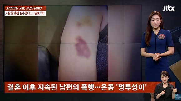 2일 JTBC 사건반장은 자신의 남편이 용변 실수를 한 딸에게 발길질을 했다는 아내의 제보를 보도했다. JTBC 사건반장 캡처