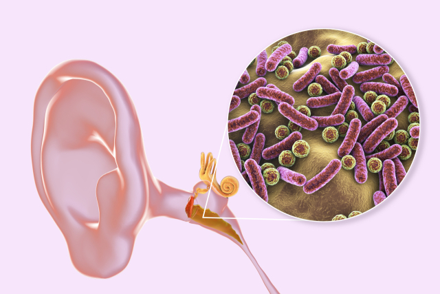 외이도염은 외이도에 세균이 번식하면서 발생하는 경우가 많다. 클립아트코리아 제공.