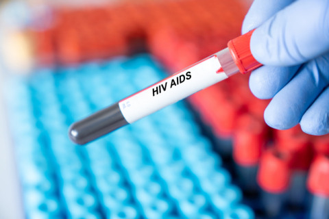 HIV 감염 예방 주사제, 사이언스誌 '올해의 혁신'에 선정