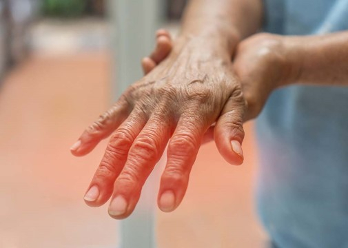 손가락 등 작은 관절에 통증과 붓기가 느껴진다면 류마티스 관절염을 의심해 볼 수 있다. 곽병원 제공.